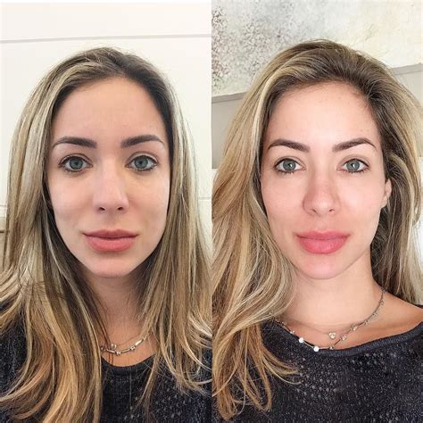 Antes e Depois .